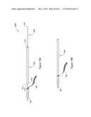 SYSTEMS, METHODS AND DEVICES RELATING TO IMPLANTABLE SUPPORTIVE SLINGS diagram and image