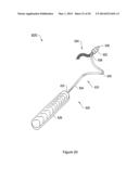 SYSTEMS, METHODS AND DEVICES RELATING TO IMPLANTABLE SUPPORTIVE SLINGS diagram and image