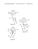 SYSTEMS, METHODS AND DEVICES RELATING TO IMPLANTABLE SUPPORTIVE SLINGS diagram and image