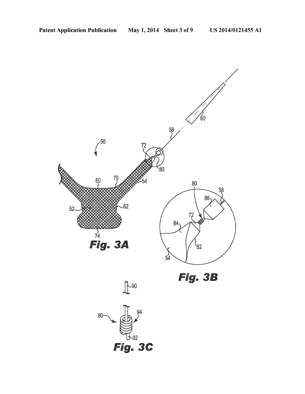 IMPLANTABLE SUPPORT WITH DILATOR ATTACHED TO ARM - diagram, schematic, and image 04