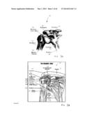 METHODS AND APPARATUS FOR SIMULTANEOUS RETRACTION AND DISTRACTION OF BONE     AND SOFT TISSUE diagram and image