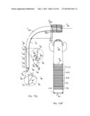 METHODS AND APPARATUS FOR SIMULTANEOUS RETRACTION AND DISTRACTION OF BONE     AND SOFT TISSUE diagram and image