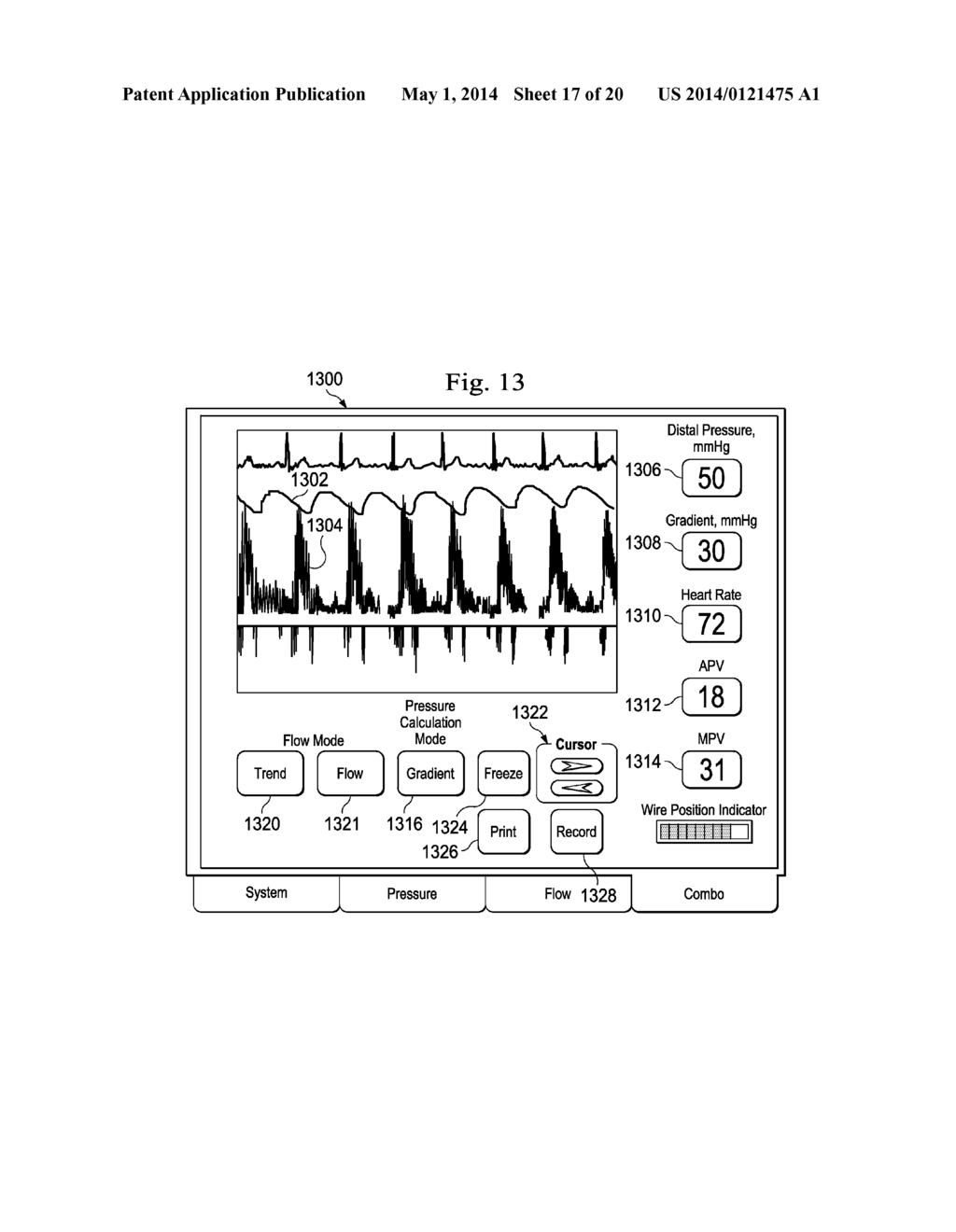 Multipurpose Host System for Invasive Cardiovascular Diagnostic     Measurement Acquisition and Display - diagram, schematic, and image 18