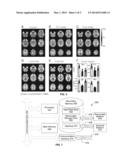 Method To Diagnose and Measure Vascular Drainage Insufficiency in the     Central Nervous System diagram and image