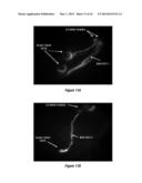 METHOD OF MEASURING PROPULSION IN LYMPHATIC STRUCTURES diagram and image