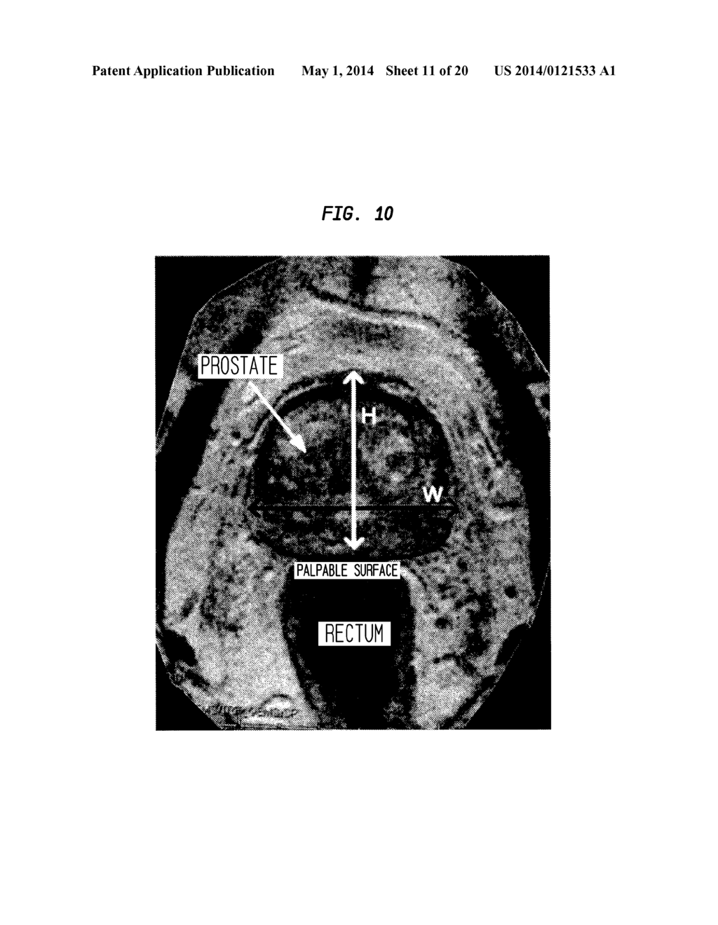 DOUBLE MEMBRANE PROSTATE GLOVE - diagram, schematic, and image 12