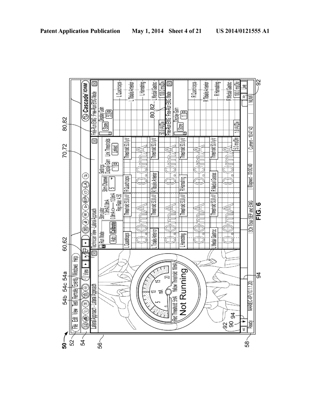 NEUROMONITORING SYSTEMS AND METHODS - diagram, schematic, and image 05