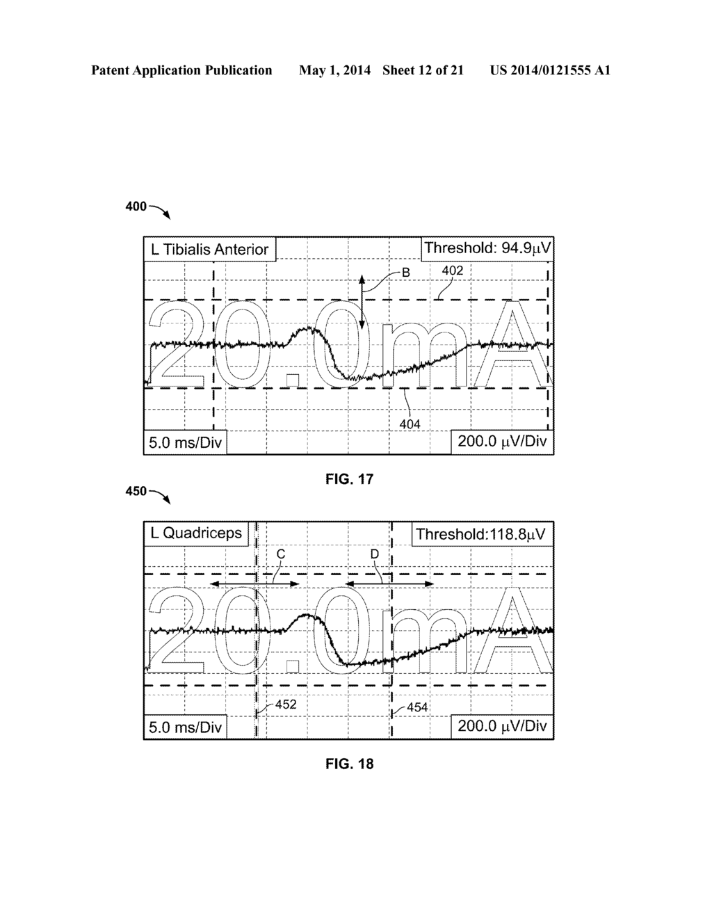 NEUROMONITORING SYSTEMS AND METHODS - diagram, schematic, and image 13