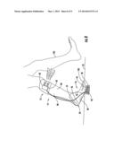 ORTHOTIC FEEDBACK SYSTEM diagram and image