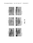 INJECTION NEEDLE AND DEVICE diagram and image