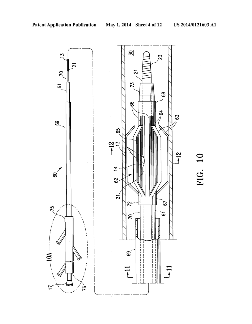 AGENT DELIVERY CATHETER HAVING RADIALLY EXPANDABLE CENTERING SUPPORT     MEMBER - diagram, schematic, and image 05