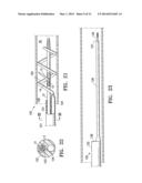 AGENT DELIVERY CATHETER HAVING RADIALLY EXPANDABLE CENTERING SUPPORT     MEMBER diagram and image