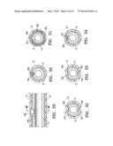 AGENT DELIVERY CATHETER HAVING RADIALLY EXPANDABLE CENTERING SUPPORT     MEMBER diagram and image