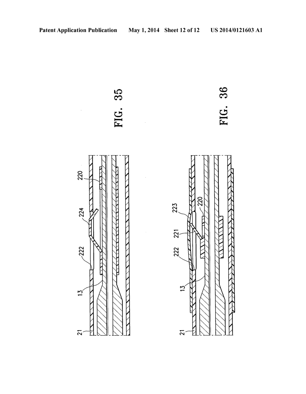 AGENT DELIVERY CATHETER HAVING RADIALLY EXPANDABLE CENTERING SUPPORT     MEMBER - diagram, schematic, and image 13