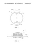 Ophthalmic System for Sustained Release of Drug to Eye diagram and image