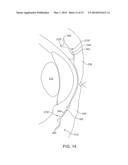 Ophthalmic System for Sustained Release of Drug to Eye diagram and image