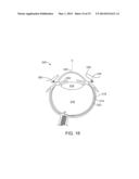 Ophthalmic System for Sustained Release of Drug to Eye diagram and image