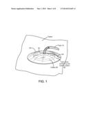 WOUND DRESSING ASSEMBLY WITH ABSORBENT LAYER diagram and image