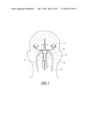 REVASCULARIZATION DEVICES diagram and image