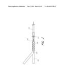 REVASCULARIZATION DEVICES diagram and image