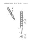 REVASCULARIZATION DEVICES diagram and image