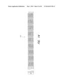 REVASCULARIZATION DEVICES diagram and image