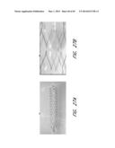 REVASCULARIZATION DEVICES diagram and image