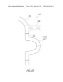 REVASCULARIZATION DEVICES diagram and image