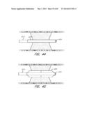 REVASCULARIZATION DEVICES diagram and image