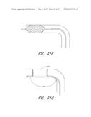 REVASCULARIZATION DEVICES diagram and image