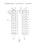 STENT AND STENT GRAFT PROSTHESIS diagram and image