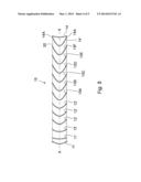 STENT AND STENT GRAFT PROSTHESIS diagram and image