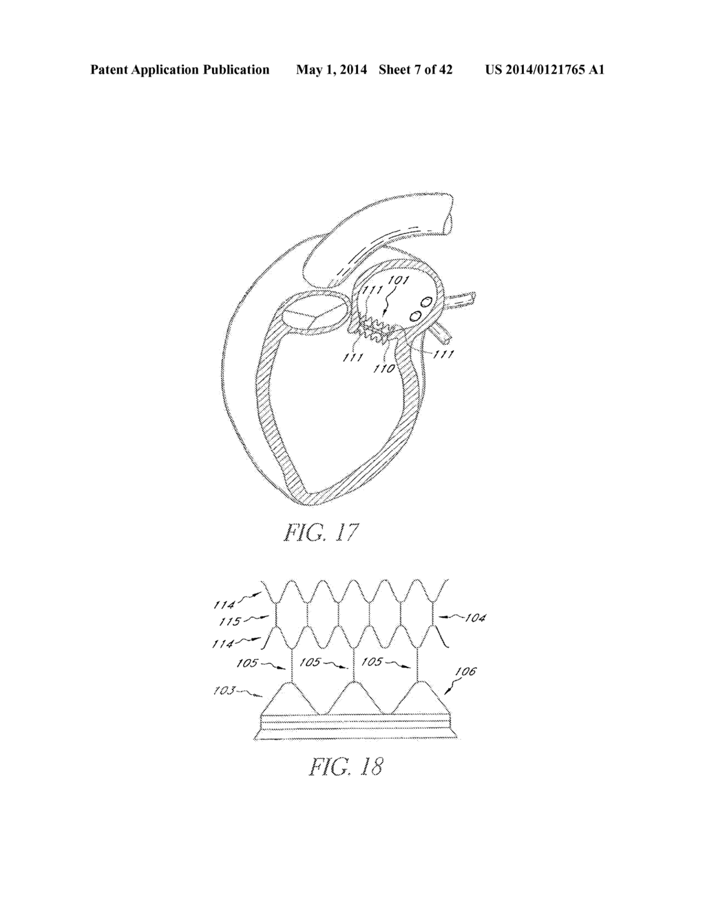 Methods For Transluminal Delivery Of Prosthetic Valves - diagram, schematic, and image 08