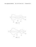 Methods For Transluminal Delivery Of Prosthetic Valves diagram and image