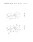 Methods For Transluminal Delivery Of Prosthetic Valves diagram and image