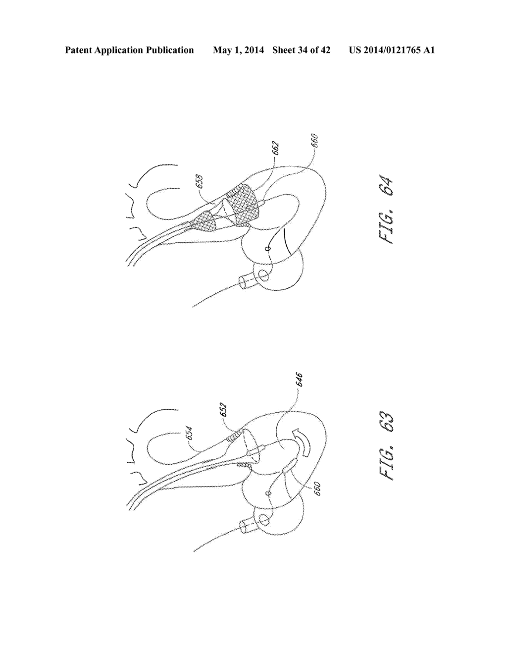 Methods For Transluminal Delivery Of Prosthetic Valves - diagram, schematic, and image 35