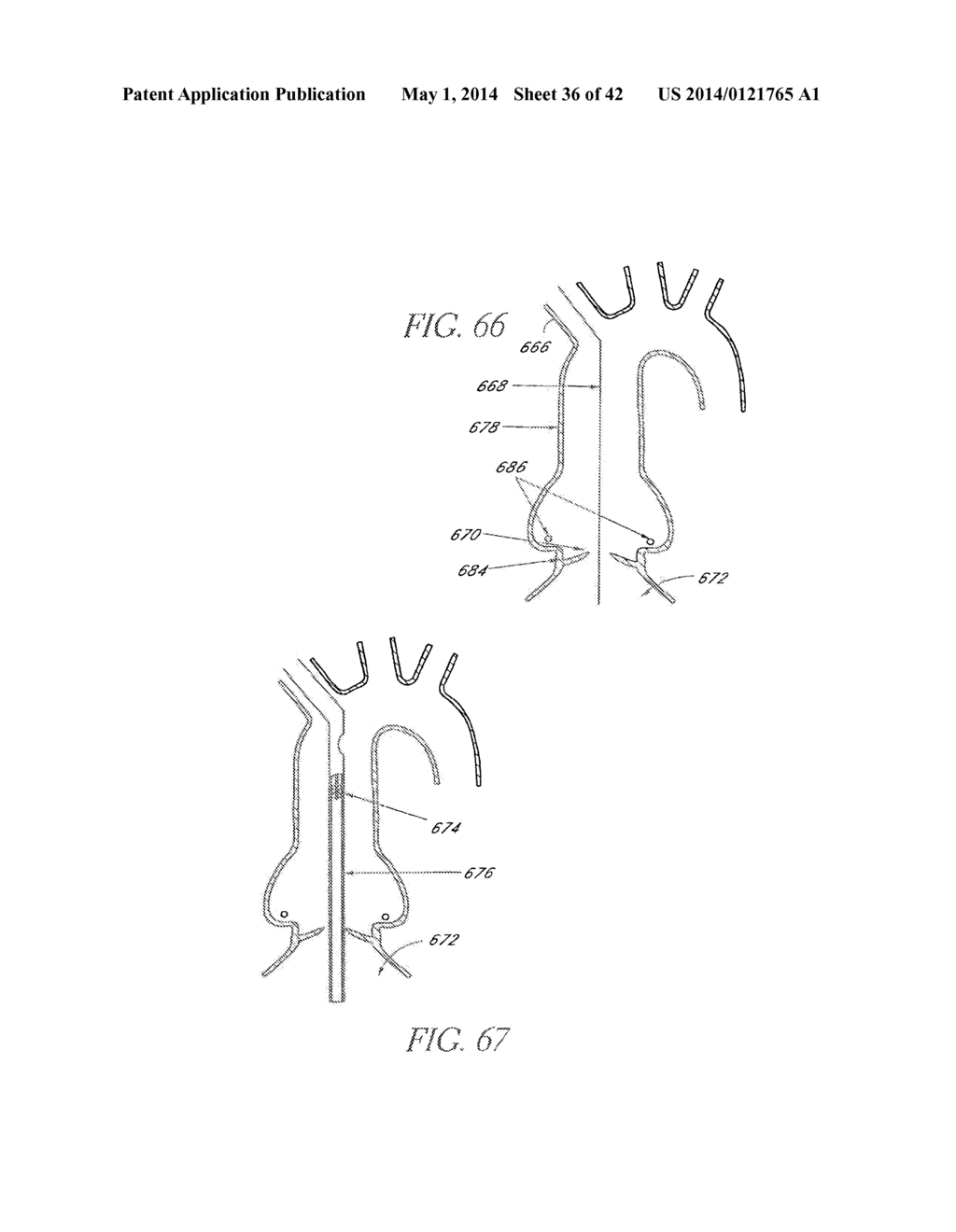 Methods For Transluminal Delivery Of Prosthetic Valves - diagram, schematic, and image 37