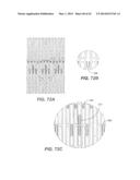 Methods For Transluminal Delivery Of Prosthetic Valves diagram and image