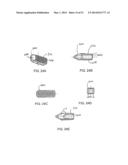 Multi-Piece Intervertebral Implants diagram and image