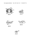 Multi-Piece Intervertebral Implants diagram and image