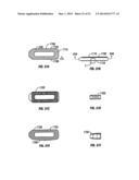 Multi-Piece Intervertebral Implants diagram and image