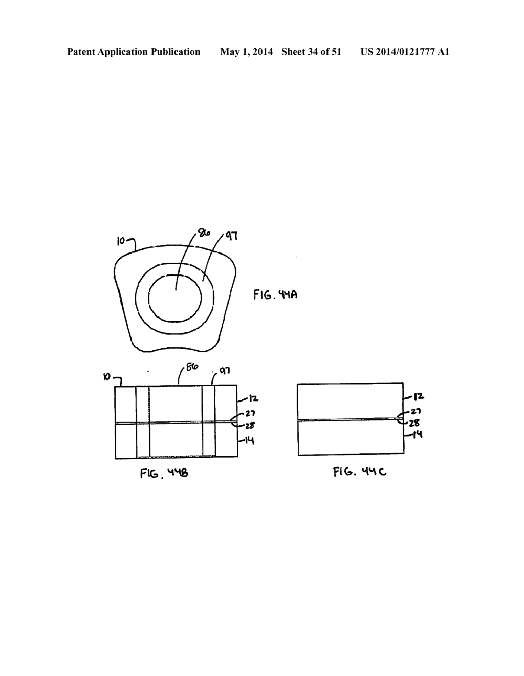 Multi-Piece Intervertebral Implants - diagram, schematic, and image 35