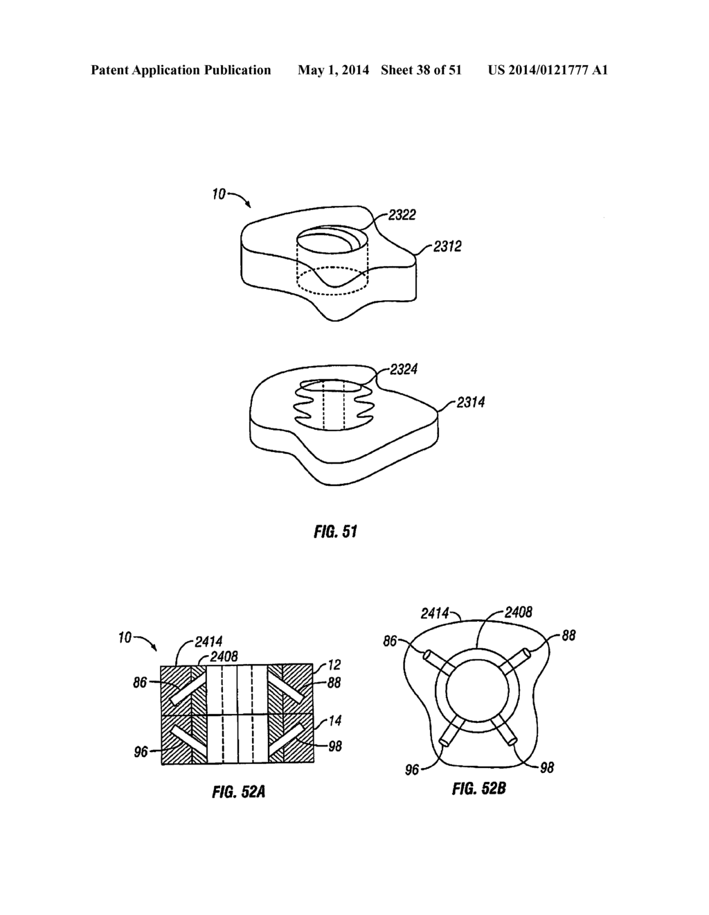 Multi-Piece Intervertebral Implants - diagram, schematic, and image 39