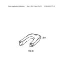 Multi-Piece Intervertebral Implants diagram and image