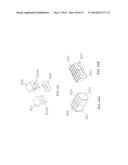 Multi-Piece Intervertebral Implants diagram and image