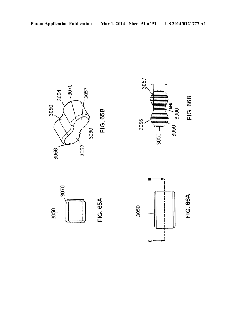 Multi-Piece Intervertebral Implants - diagram, schematic, and image 52