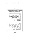 METHOD, SYSTEM, AND COMPUTER PROGRAM PRODUCT TO PERFORM DIGITAL     ORTHODONTICS AT ONE OR MORE SITES diagram and image