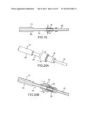 Assembly of Passive Cardiac Electrical Lead diagram and image