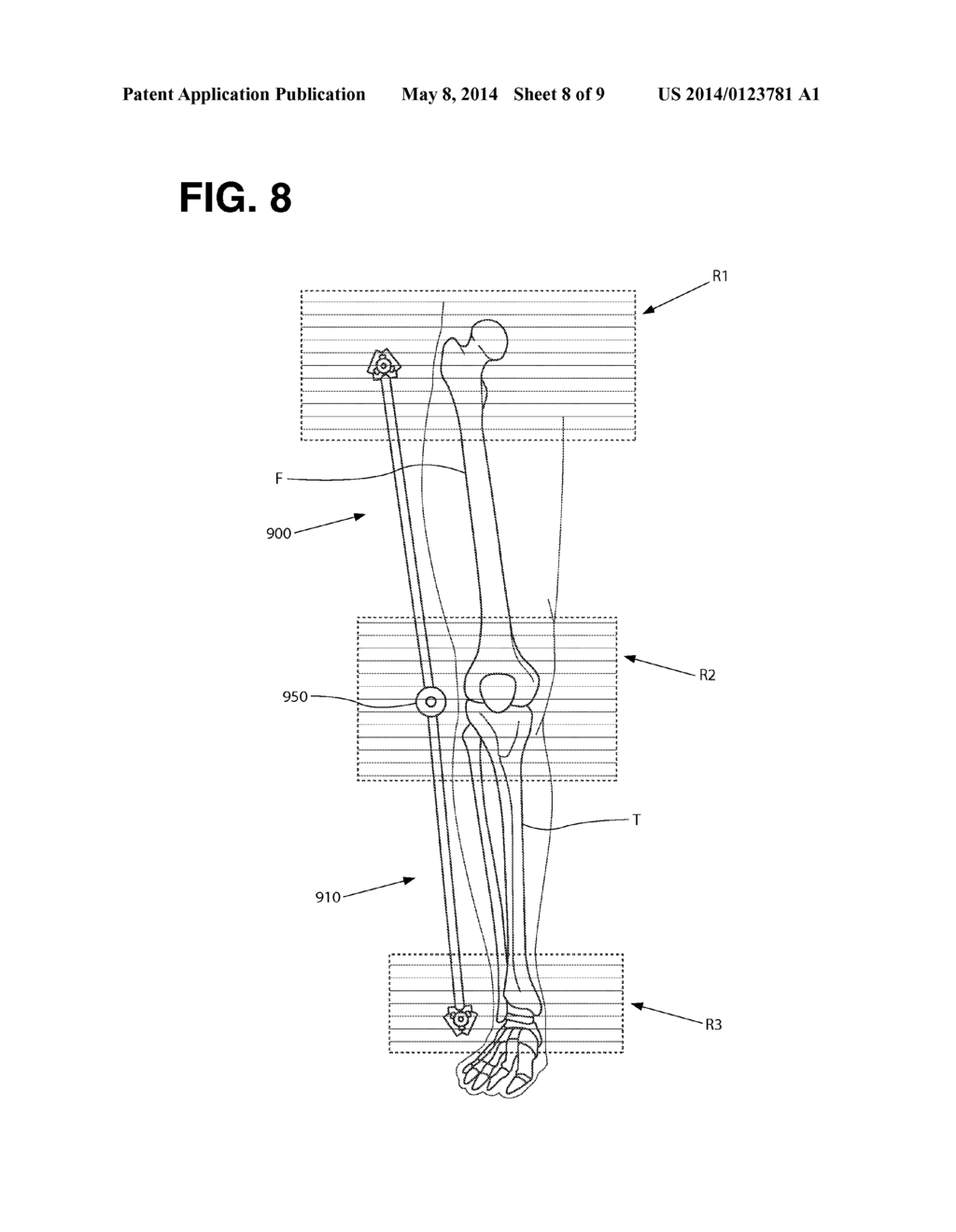 DEVICES, SYSTEMS, AND METHODS FOR NON-INVASIVE IMAGING OF ANATOMY - diagram, schematic, and image 09