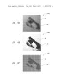 DEVICES AND METHODS FOR IDENTIFYING AND MONITORING CHANGES OF A SUSPECT     AREA OF A PATIENT diagram and image